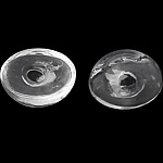 5 ovala glaskulor att fylla